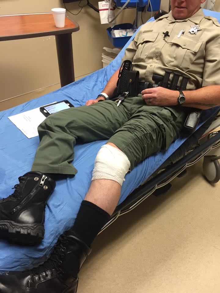 Deputy J.D. Qualls lays on a hospital bed with his leg bandaged after being injured  